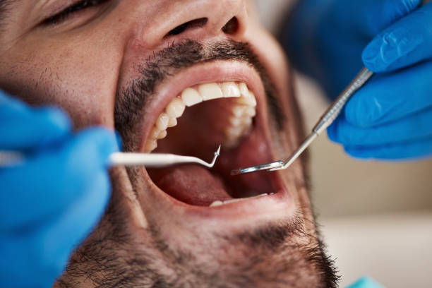 Professional Emergency Dental Service in TN